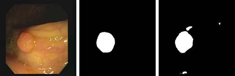 CVC-612 polyp segmentation result