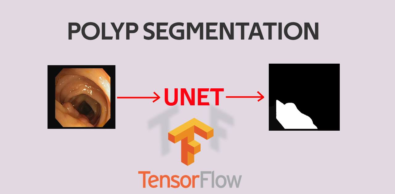 Polyp Segmentation using UNET in TensorFlow 2.0