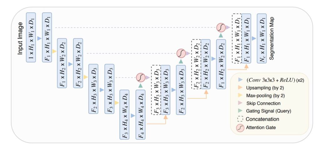 Attention UNET and its Implementation in TensorFlow