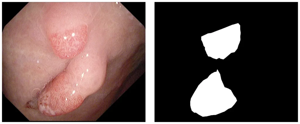 The polyp image and its respective binary mask.